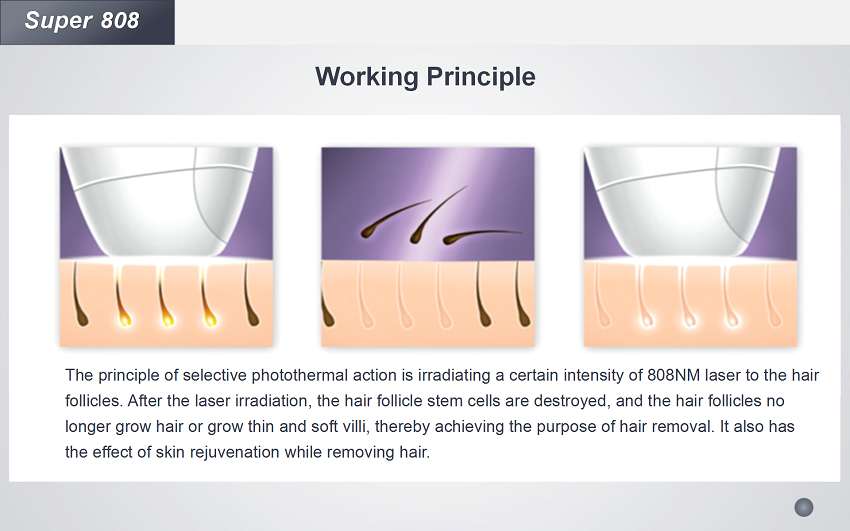 Best 3 Wavelength Diode Laser Hair Removal Machine Buy best diode